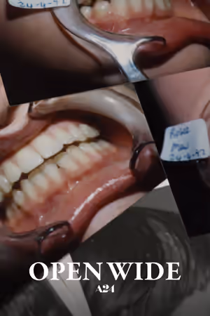 Open Wide (2024) Set poster